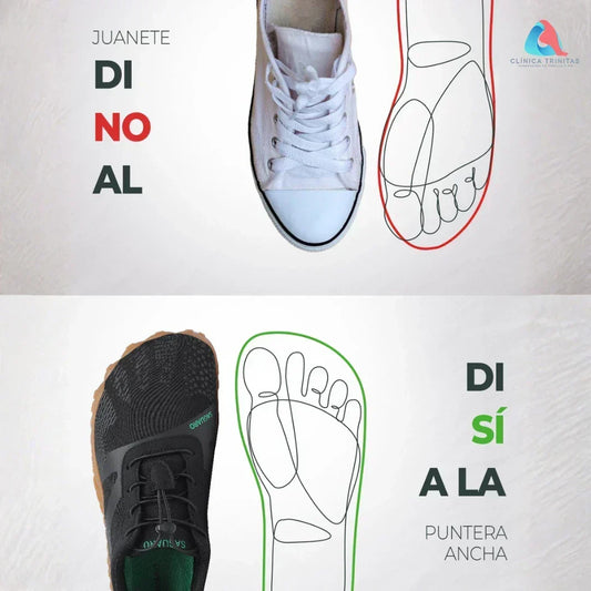 Hallux Valgus (Juanetes): Qué Calzado Alivia y Cuál Empeora la Condición